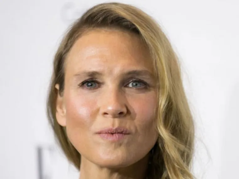 Kad se poznati unakaze plastičnim operacijama, rezultati mogu biti zastra&scaron;ujući