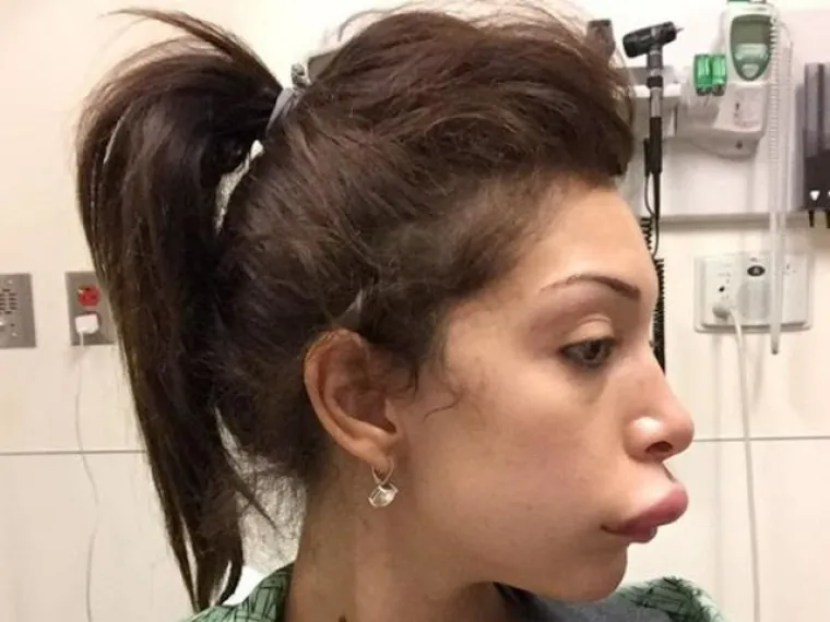 Kad se poznati unakaze plastičnim operacijama, rezultati mogu biti zastra&scaron;ujući