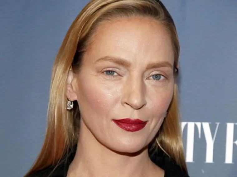 Kad se poznati unakaze plastičnim operacijama, rezultati mogu biti zastra&scaron;ujući