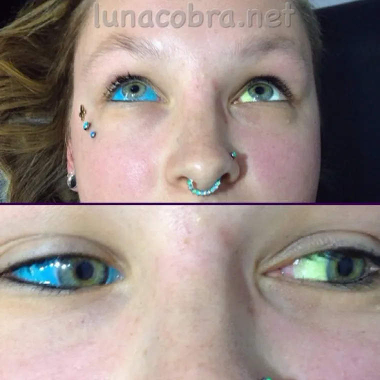 Tetoviranje očnih jabučica postalo je stvarnost i sve je vi&scaron;e onih koji ga žele