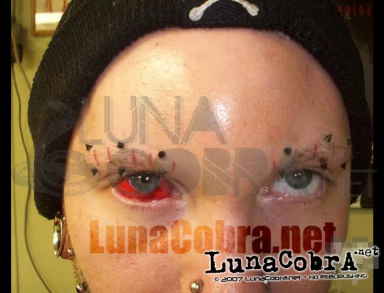 Tetoviranje očnih jabučica postalo je stvarnost i sve je vi&scaron;e onih koji ga žele