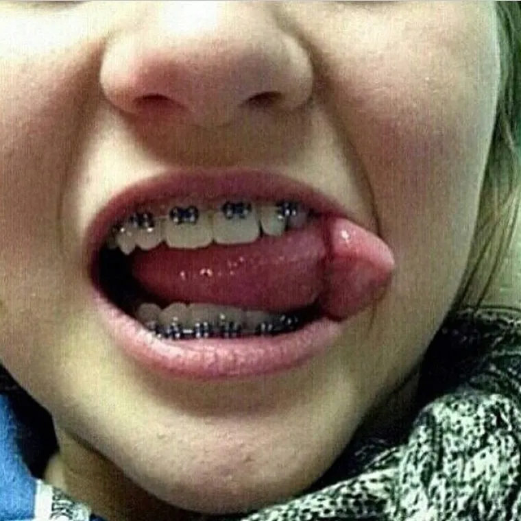 JESTE LI PERVERZNJAK? Ovisi o tome &scaron;to sve vidite na fotografijama...