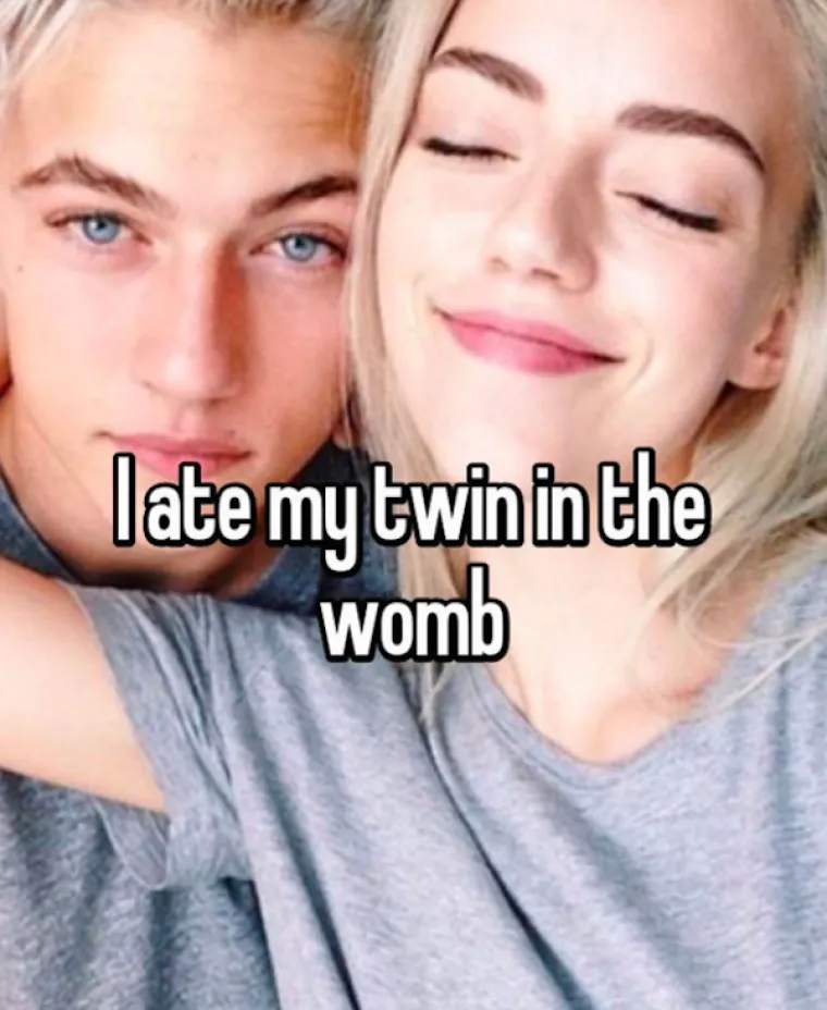 "Pojeo sam svog blizanca u utrobi"