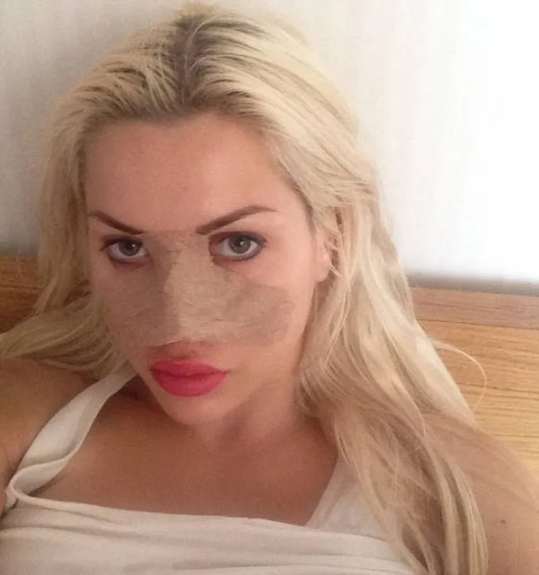 &Scaron;vedska ljepotica potro&scaron;ila 120.000 dolara da bi izgledala... ovako