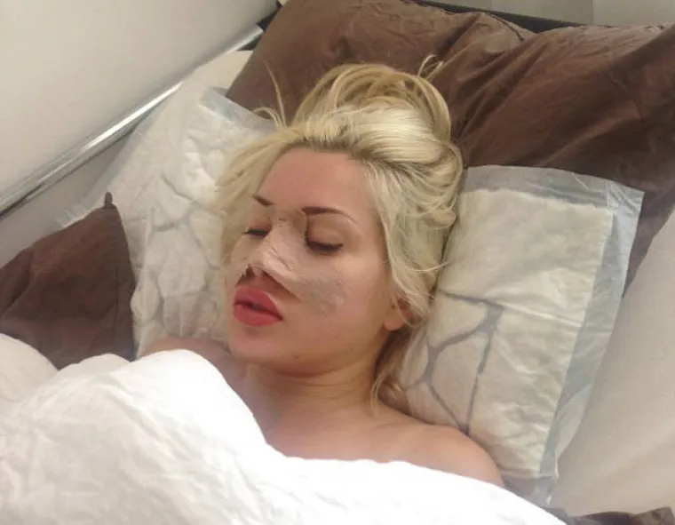 &Scaron;vedska ljepotica potro&scaron;ila 120.000 dolara da bi izgledala... ovako