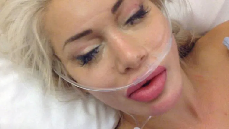 &Scaron;vedska ljepotica potro&scaron;ila 120.000 dolara da bi izgledala... ovako