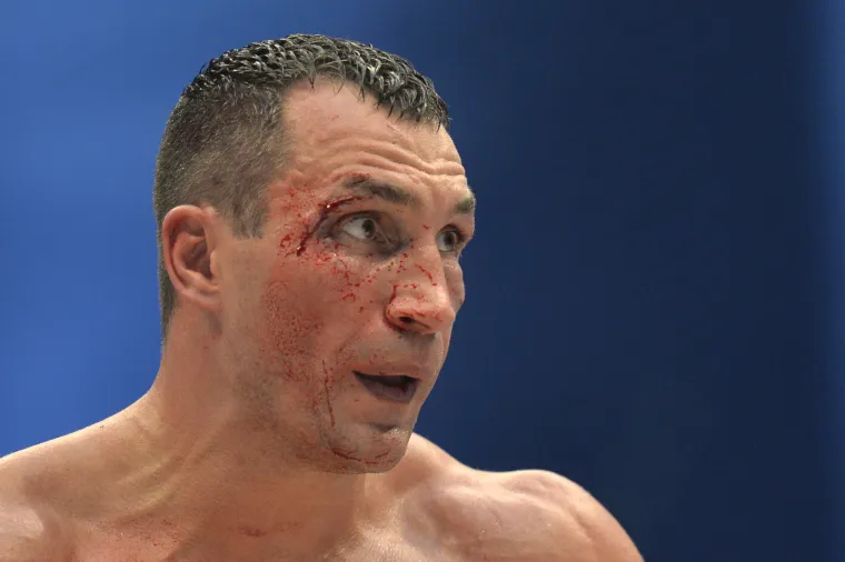 Tyson Fury porazio Klička i postao novi svjetski prvak