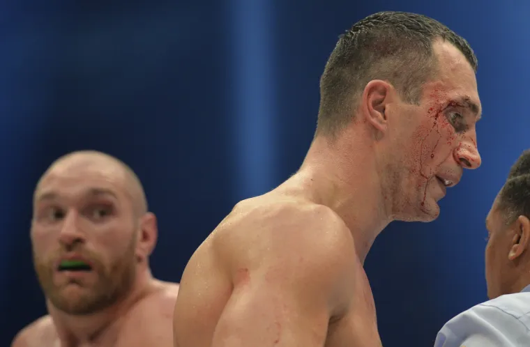 Tyson Fury porazio Klička i postao novi svjetski prvak