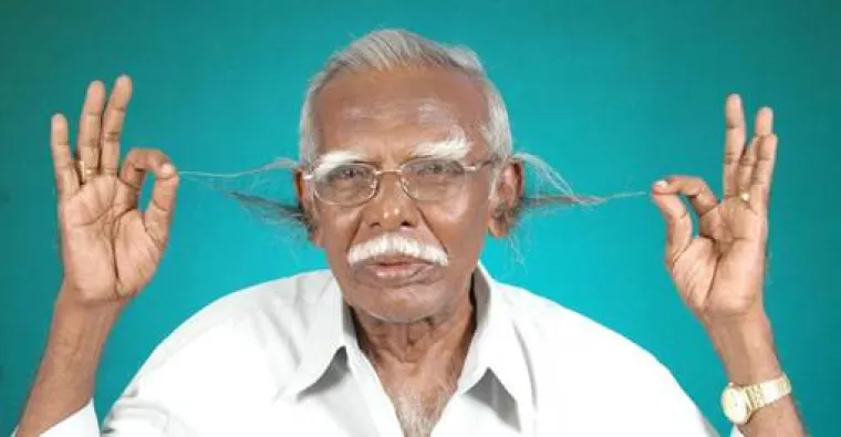 Anthony Victor ima dlake u u&scaron;ima dužine 18 centimetara.