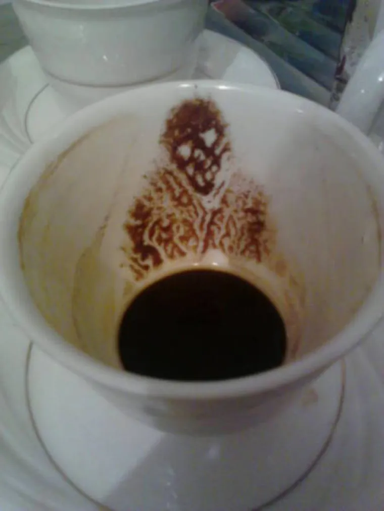 SAMO ZA HRABRE! Od ovih prizora odsjeći će vam se koljena, a moglo bi vam i pozliti