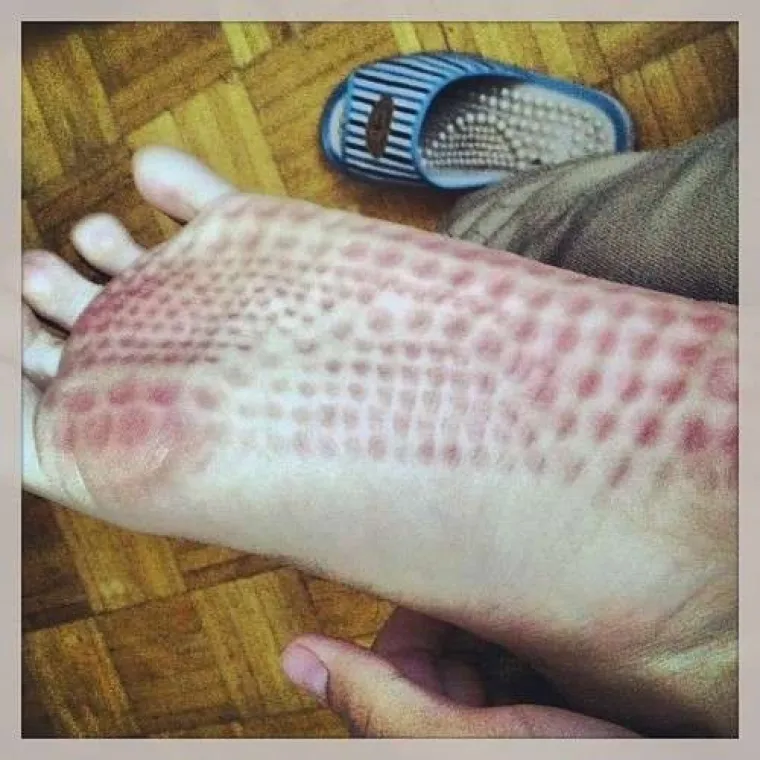 Mnogi niti ne znaju da imaju ovu fobiju, provjerite jeste li među njima