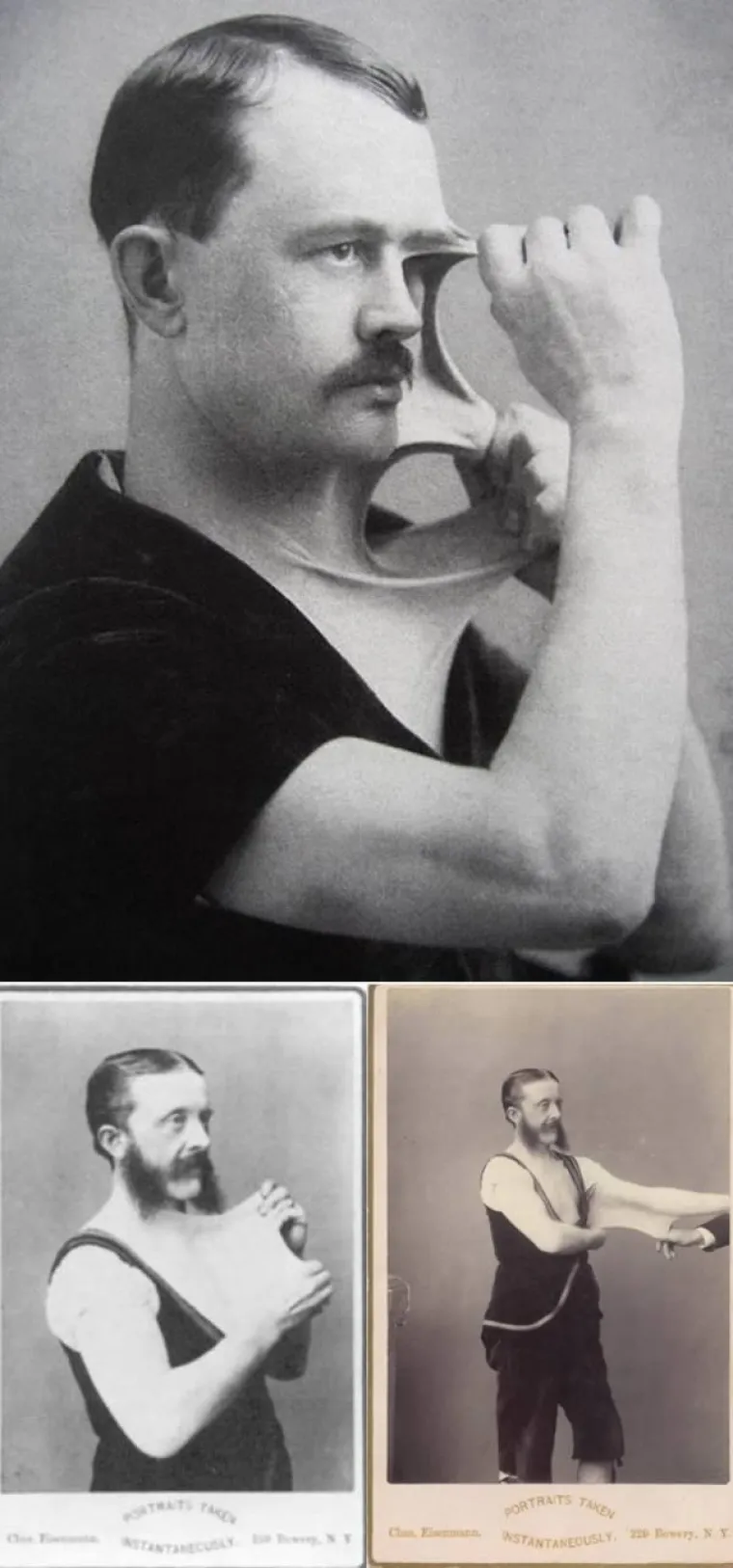 Felix Wehrle imao je Ehlers-Danlos sindrom, genetski poremećaj zbog kojeg mu je koža bila iznimno rastezljiva i mogao ju je savijati i rastezati poput tijesta.