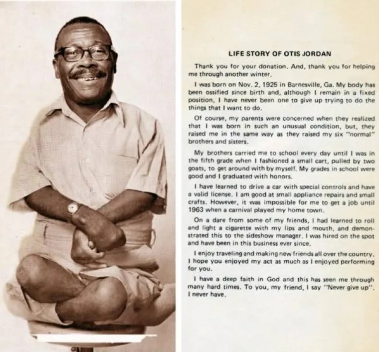 Otis Jordan bio je poznat kao Čovjek-žaba. Imao je tijelo četverogodišnjeg djeteta i odraslu glavu, a bio je poznat i po tome što je mogao smotati, zapaliti i popušiti cigaretu koristeći se samo usnama.
