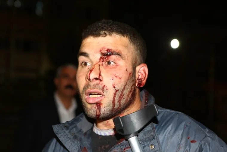 Očevici kažu da se napad dogodio blizu glavnog autobusnog kolodvora i nekoliko ministarstava na Ataturkovom bulevaru.