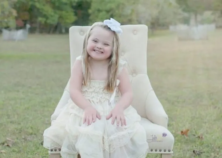 DOWNOV SINDROM NIJE PROKLETSTVO: Fotografira djecu i &scaron;alje bitnu poruku koju bi svi trebali čuti