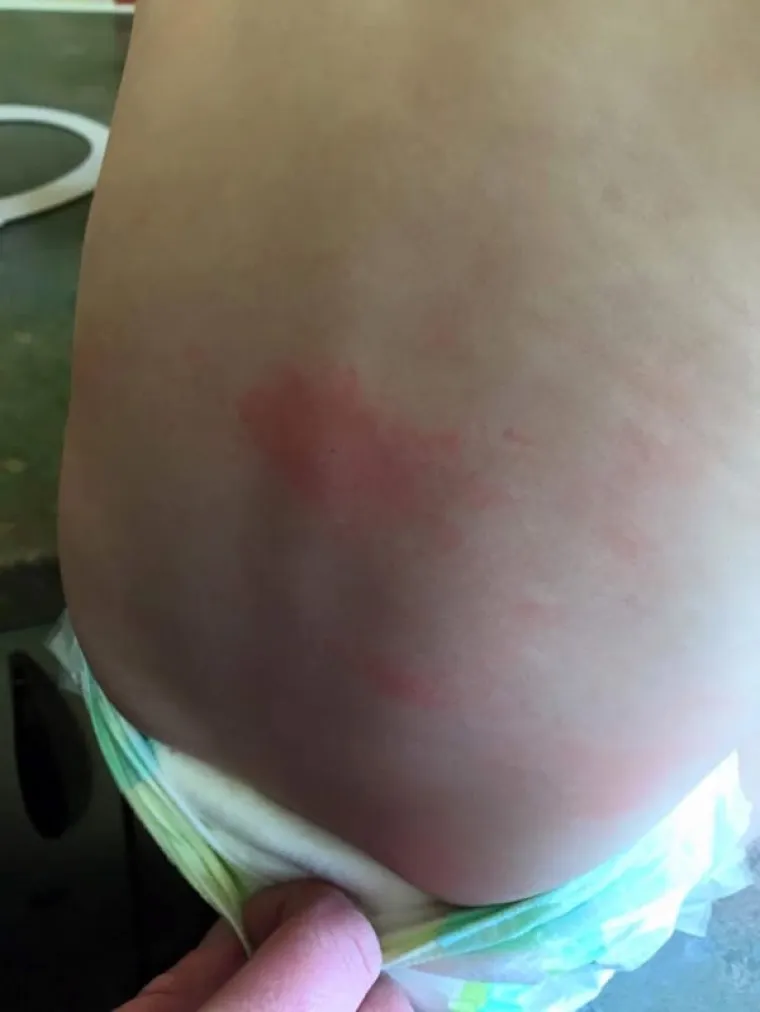 Kada je pomnije pregledala postolje za presvlačenje, vidjela je dvije &scaron;penadle koje je neki bolesnik namjerno stavio pod platno.