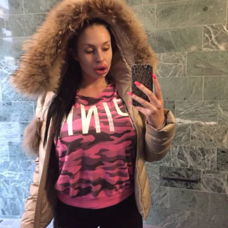 NAPUMPALE SE SILIKONIMA: Tvrde da to nisu otekline već seksipil. Slažete li se s njima?