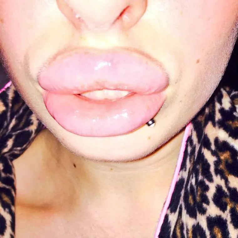 NAPUMPALE SE SILIKONIMA: Tvrde da to nisu otekline već seksipil. Slažete li se s njima?