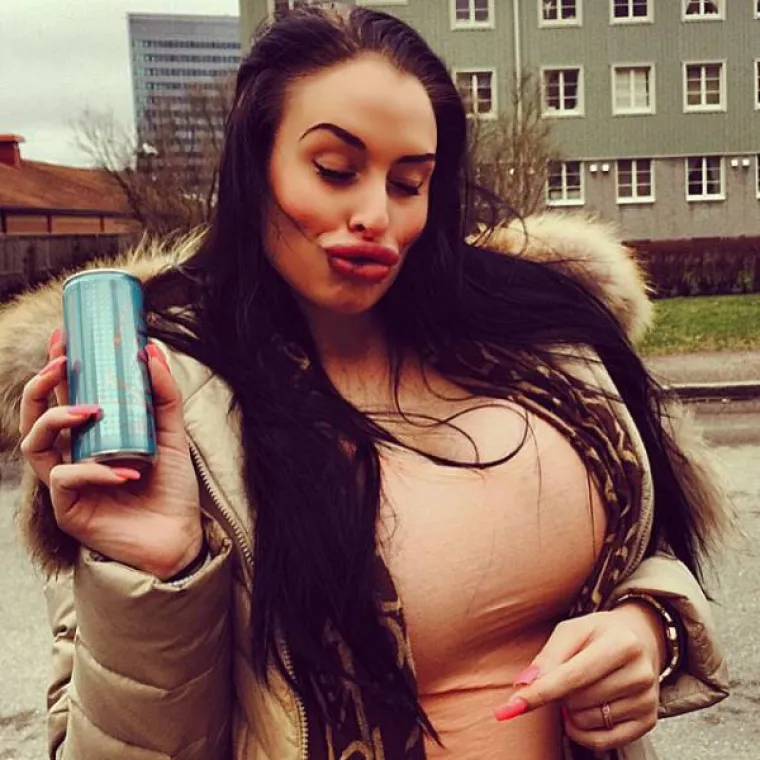 NAPUMPALE SE SILIKONIMA: Tvrde da to nisu otekline već seksipil. Slažete li se s njima?