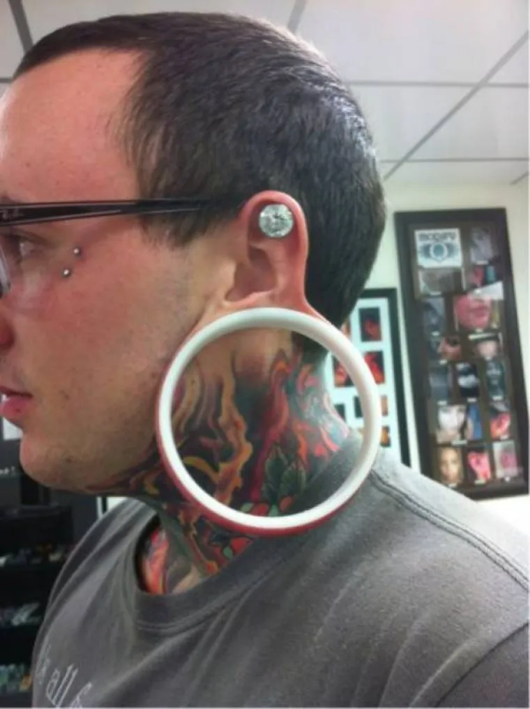 KOJA DISKRIMINACIJA! Ne mogu naći posao jer imaju previ&scaron;e željeza u krvi. I na faci