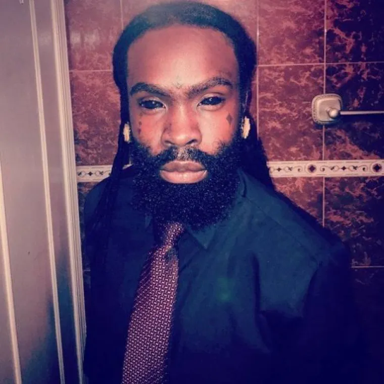 KOJA DISKRIMINACIJA! Ne mogu naći posao jer imaju previ&scaron;e željeza u krvi. I na faci