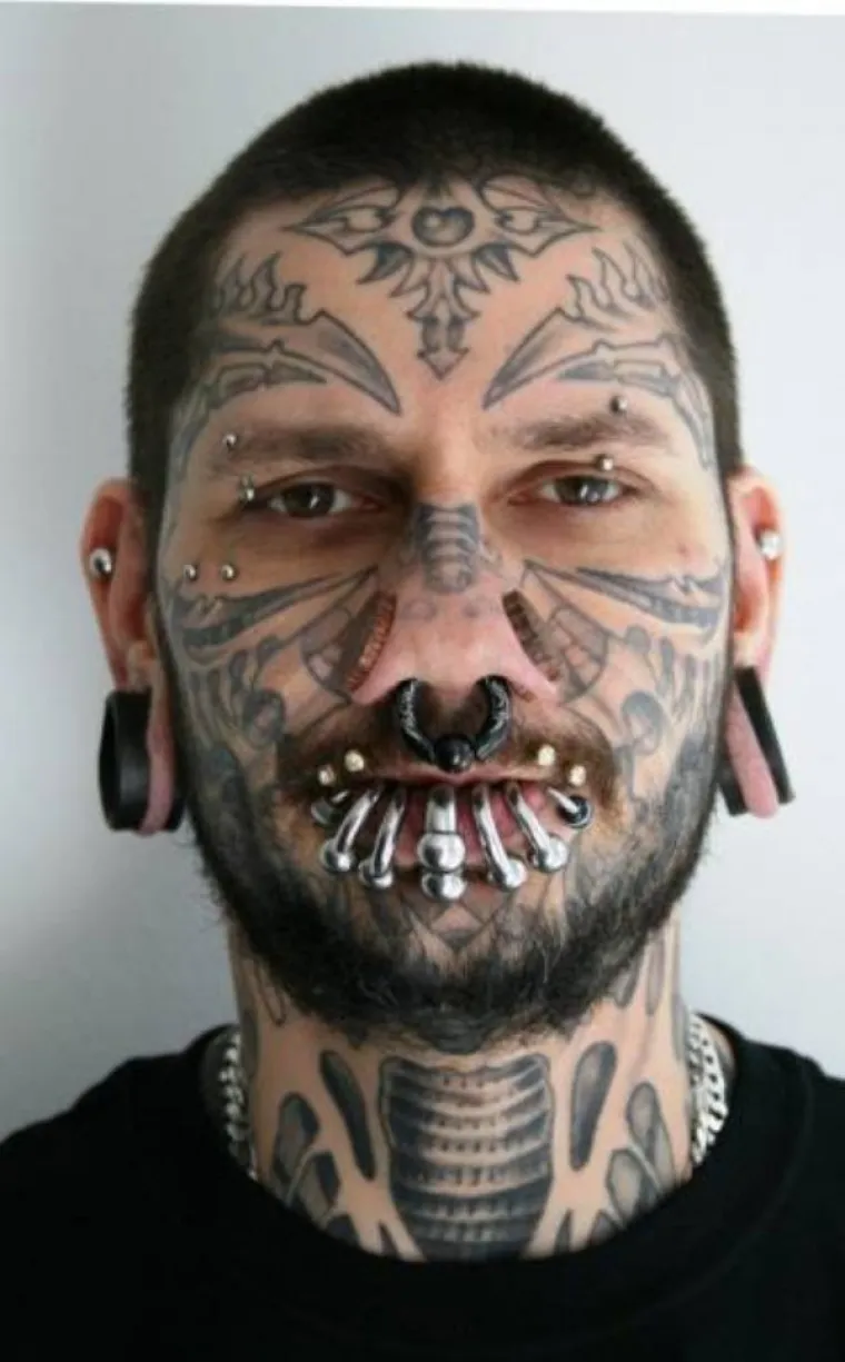 KOJA DISKRIMINACIJA! Ne mogu naći posao jer imaju previ&scaron;e željeza u krvi. I na faci