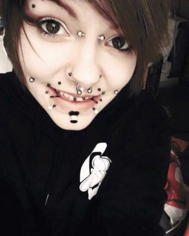 KOJA DISKRIMINACIJA! Ne mogu naći posao jer imaju previ&scaron;e željeza u krvi. I na faci