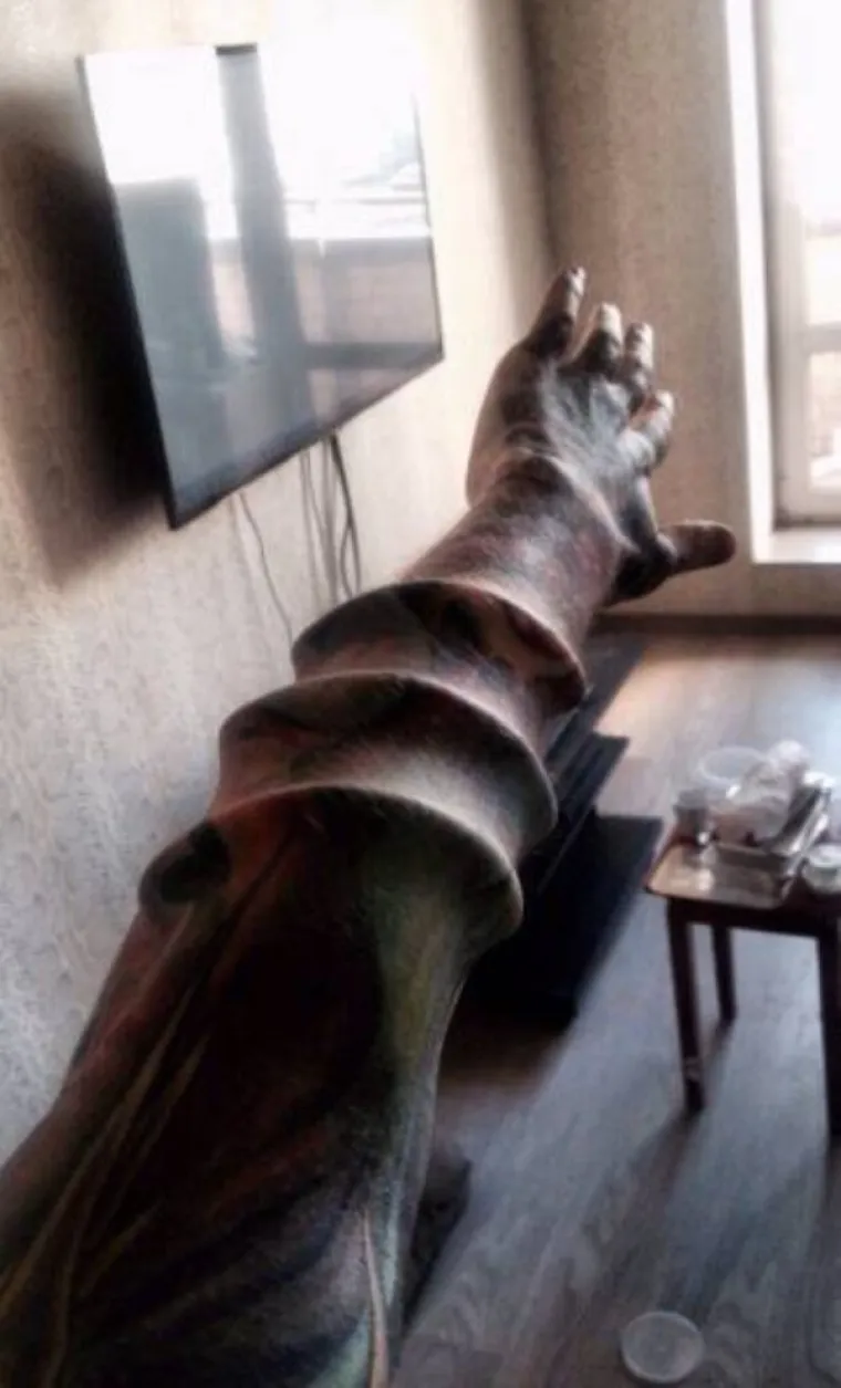 KOJA DISKRIMINACIJA! Ne mogu naći posao jer imaju previ&scaron;e željeza u krvi. I na faci