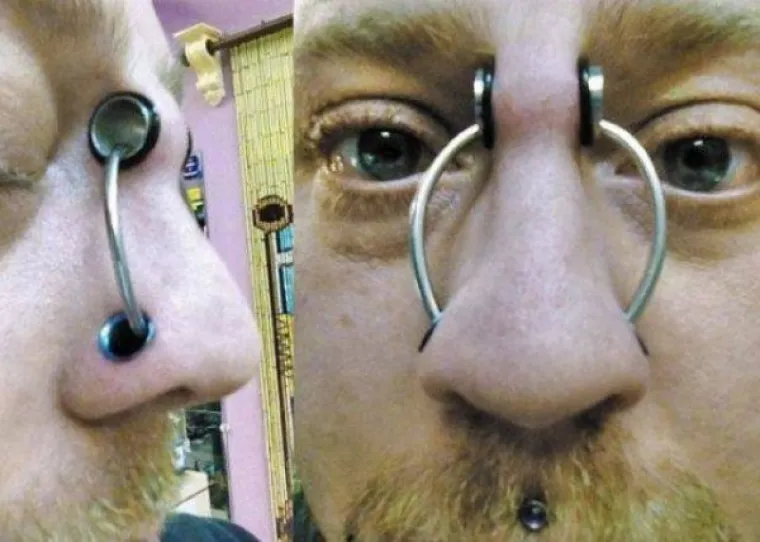 KOJA DISKRIMINACIJA! Ne mogu naći posao jer imaju previ&scaron;e željeza u krvi. I na faci