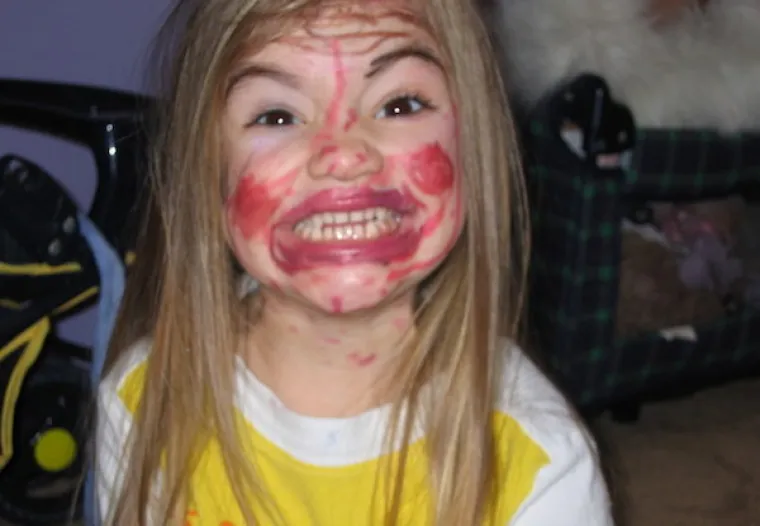 KOZMETIČKE KATASTROFE: Kad vidite &scaron;to su napravile od sebe, jo&scaron; ćete vi&scaron;e cijeniti prirodni izgled