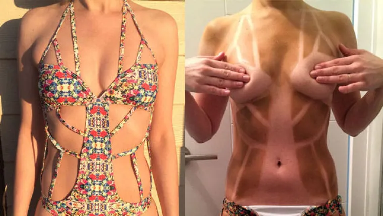 'MA, NE TREBA MENI KREMA ZA SUNČANJE': Evo kako zavr&scaron;e ljudi koji misle da su pametniji od Sunca