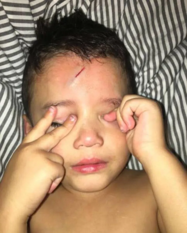 Mame se moraju nositi sa svakakvim iznenađenjima i vrlo su snalažljive. Jedna je mama nedavno postala hit na društvenim mrežama jer je smislila originalan način kako sinu popraviti ožiljak na čelu.