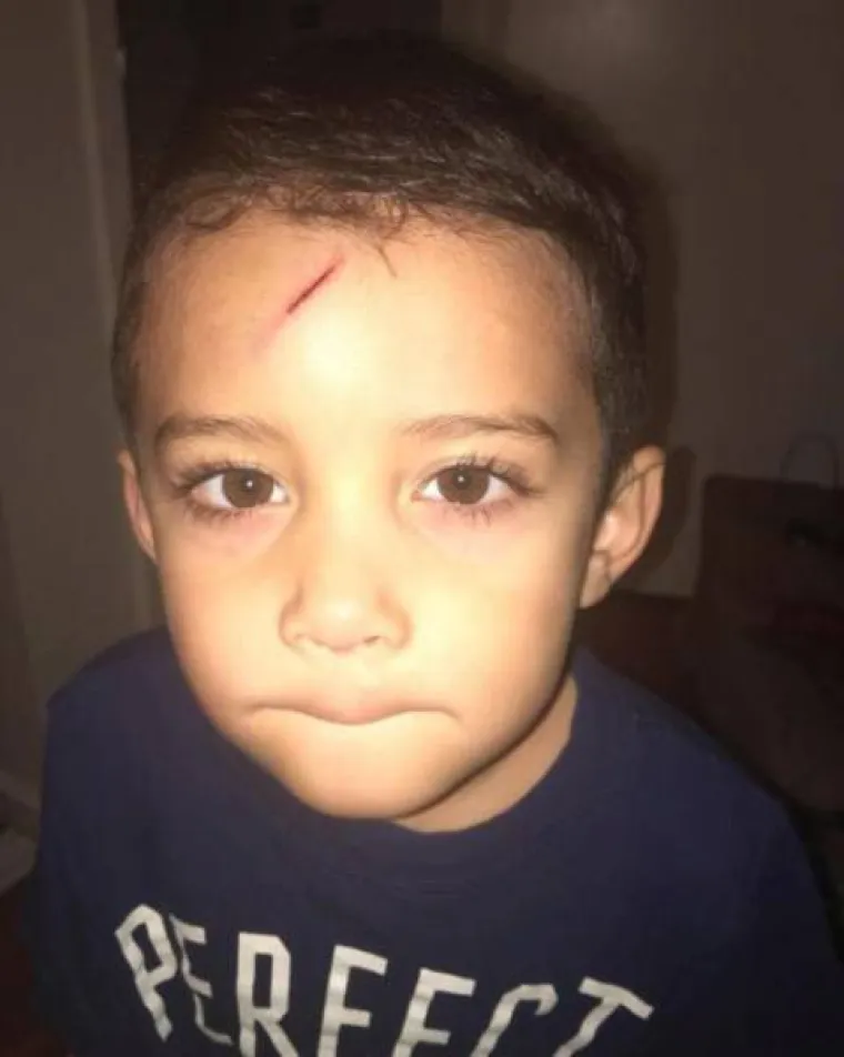 GENIJALNA MAMA! Sin malo razbio glavu, a njezina reakcija postala hit na društvenim mrežama