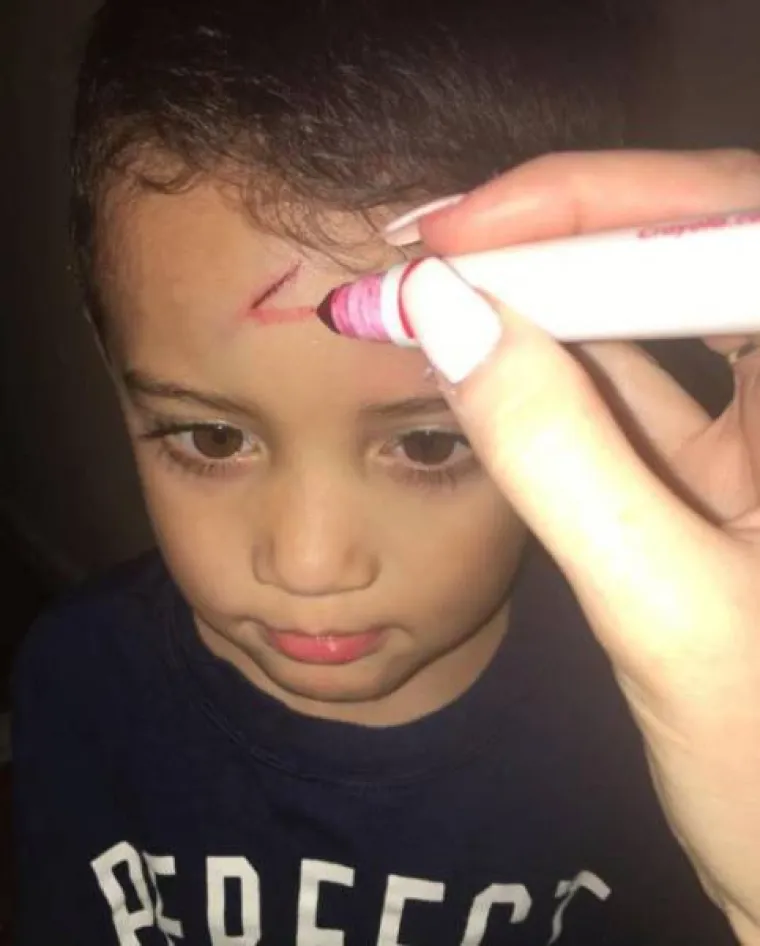 GENIJALNA MAMA! Sin malo razbio glavu, a njezina reakcija postala hit na društvenim mrežama