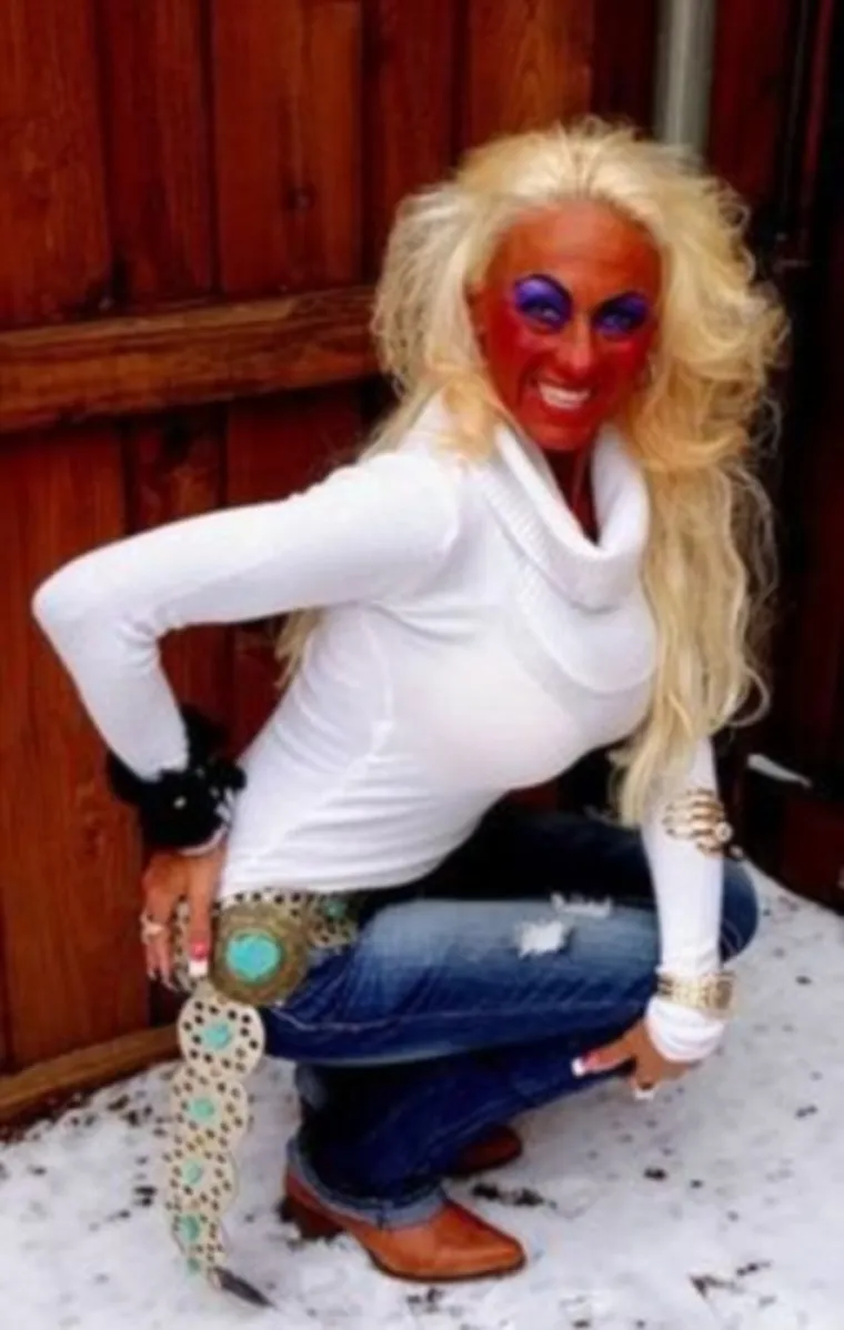 JAO, KAKVI PROMAŠAJI! Sprej za samotamnjenje trebao bi se izdavati samo na recept