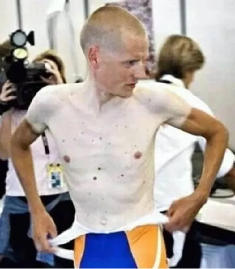 JAO, KAKVI PROMA&Scaron;AJI! Sprej za samotamnjenje trebao bi se izdavati samo na recept