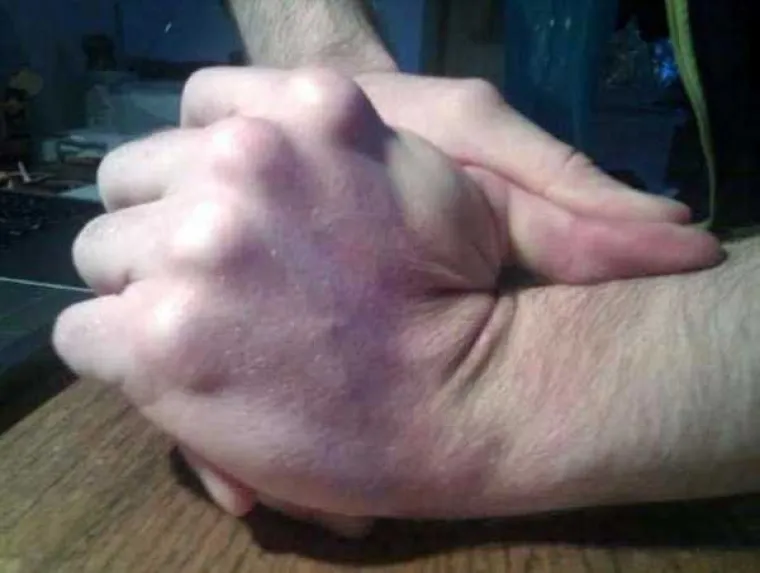 Njihovi talenti možda su impresivni, ali te&scaron;ko je zamisliti situaciju u kojoj su korisni. Kolekciju posve beskorisnih supermoći svakako pogledajte u galeriji.