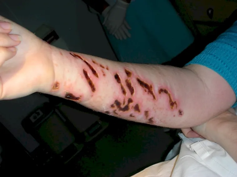 A ako ne pazite, možda vas meduze dohvate