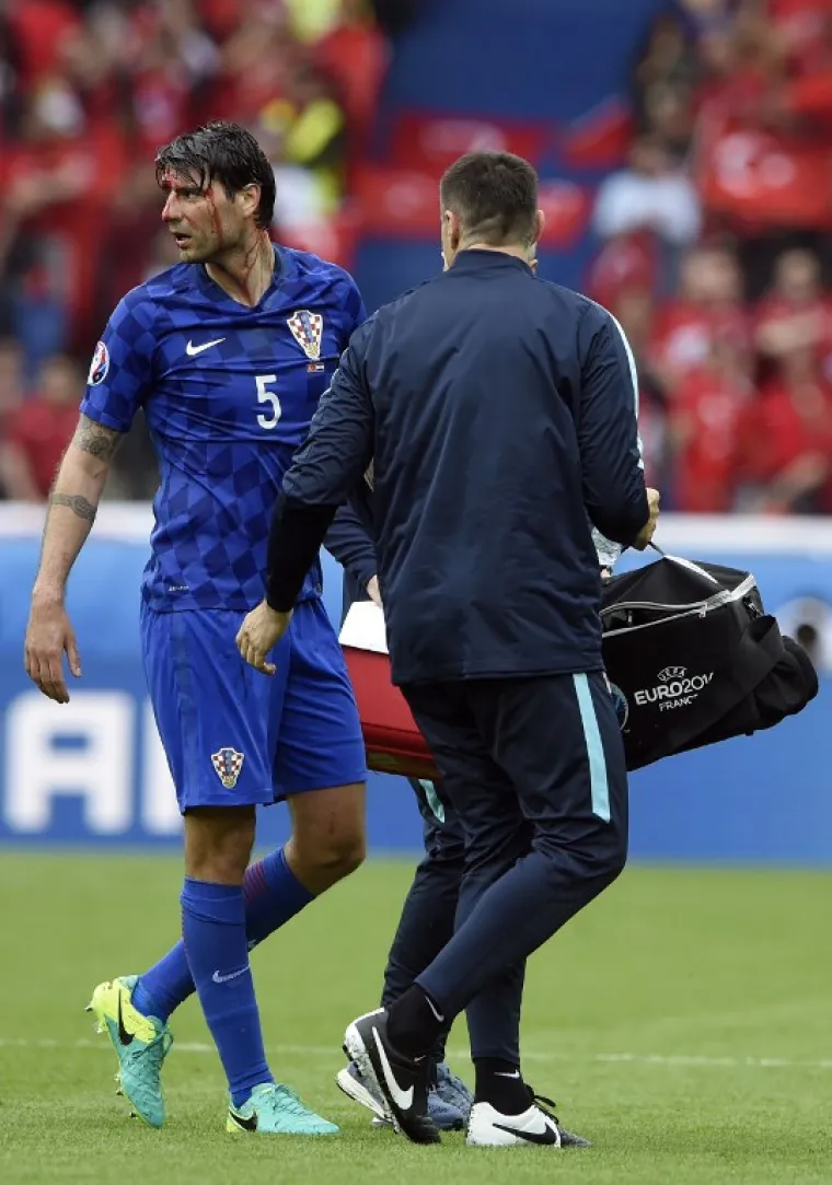 RAZBIJENI ĆORLUKA: Ni krvava glava nije zaustavila hrvatskog stopera