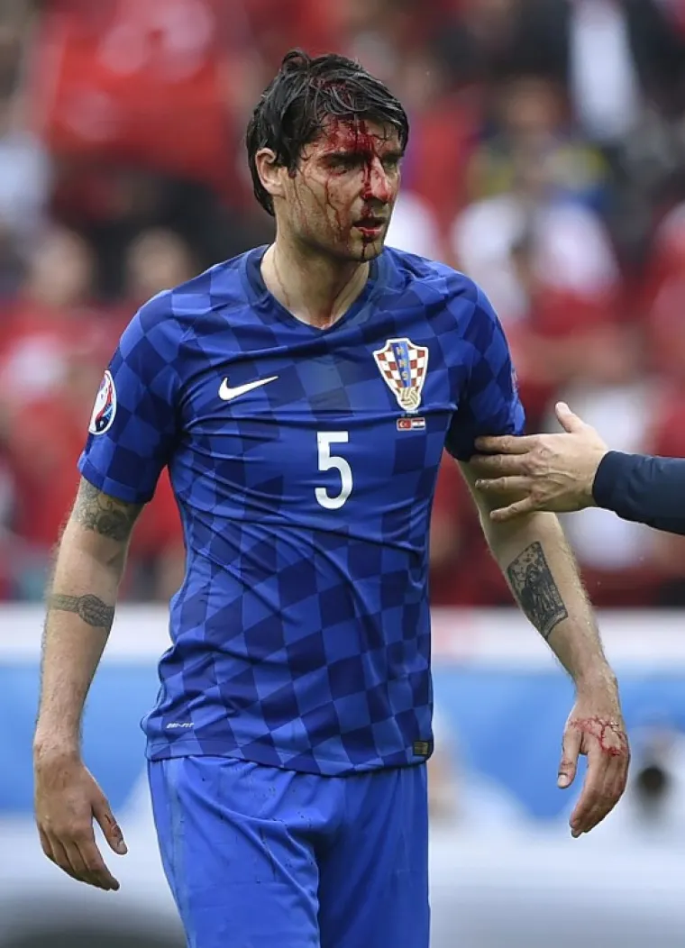 Napadač Cenk Tosun u zračnom je duelu laktom razbio glavu Vedranu Ćorluki.