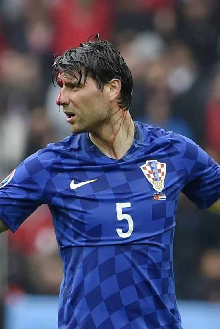 RAZBIJENI ĆORLUKA: Ni krvava glava nije zaustavila hrvatskog stopera