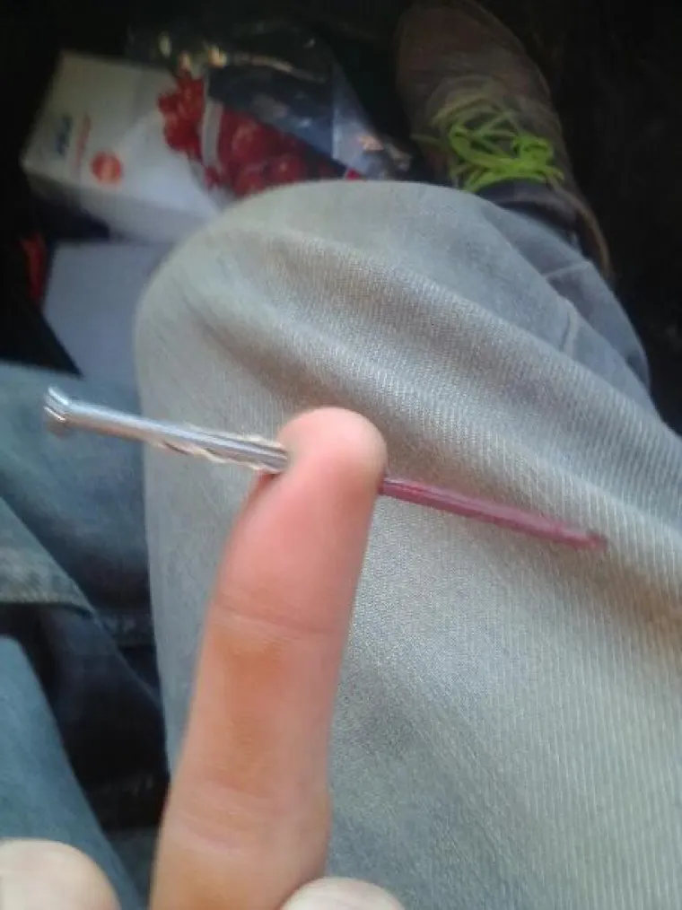 TEST ZA NAJIZDRŽLJIVIJE: Možete li pogledati njihove odvratne ozljede? Većina odustane već nakon treće