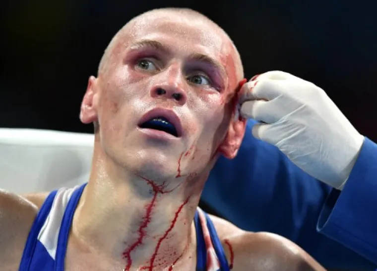 Vladimir Nikitin, ruski boksač koji je na kontroverzan način pobijedio Irca Michaela Conlana u četvrtfinalnoj borbi na Olimpijskim igrama u Rio de Janeiru, neće boksati polufinale olimpijskog boksačkog turnira zbog ozljede glave.