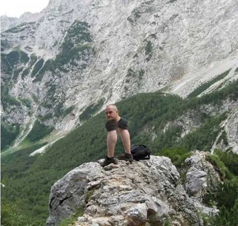 ONI SU ČUDOVIŠTA! Ljudi koji izgledaju toliko groteskno da ćete imati noćne more