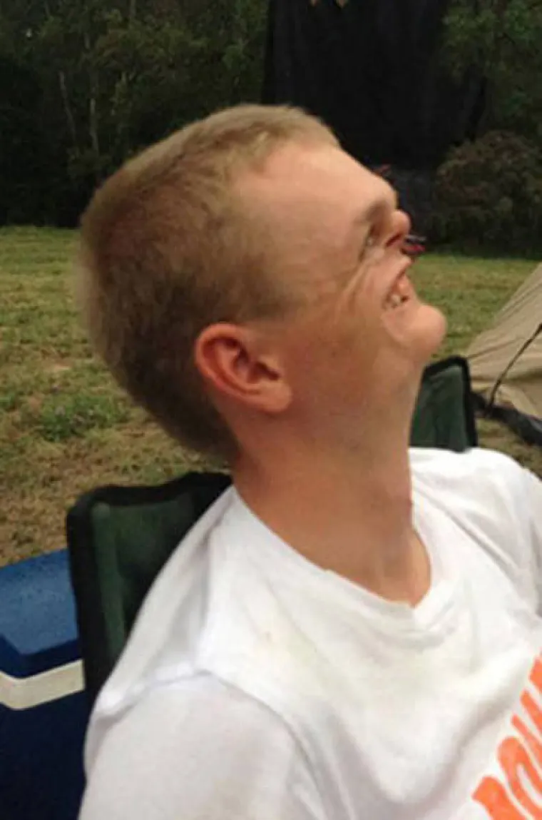 ONI SU ČUDOVI&Scaron;TA! Ljudi koji izgledaju toliko groteskno da ćete imati noćne more