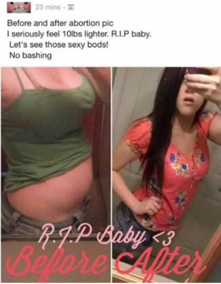 'IMAM SUPER LINIJU NAKON ABORTUSA, RIP BEBA': Facebook je pun čudaka i ljudskog smeća, ovo su neki od njih