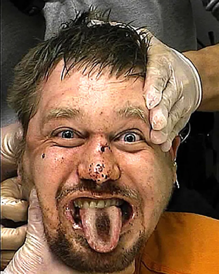 PAKAO SU DRUGI LJUDI: Njihova lica s tjeralica izgledaju kao da su ih opsjeli demoni