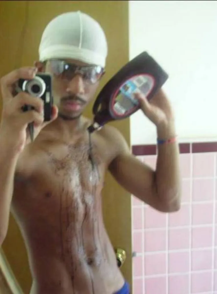 BOLEST ILI UMJETNOST? Ove fotografije pogađaju točno u jednu vrlo morbidnu žicu