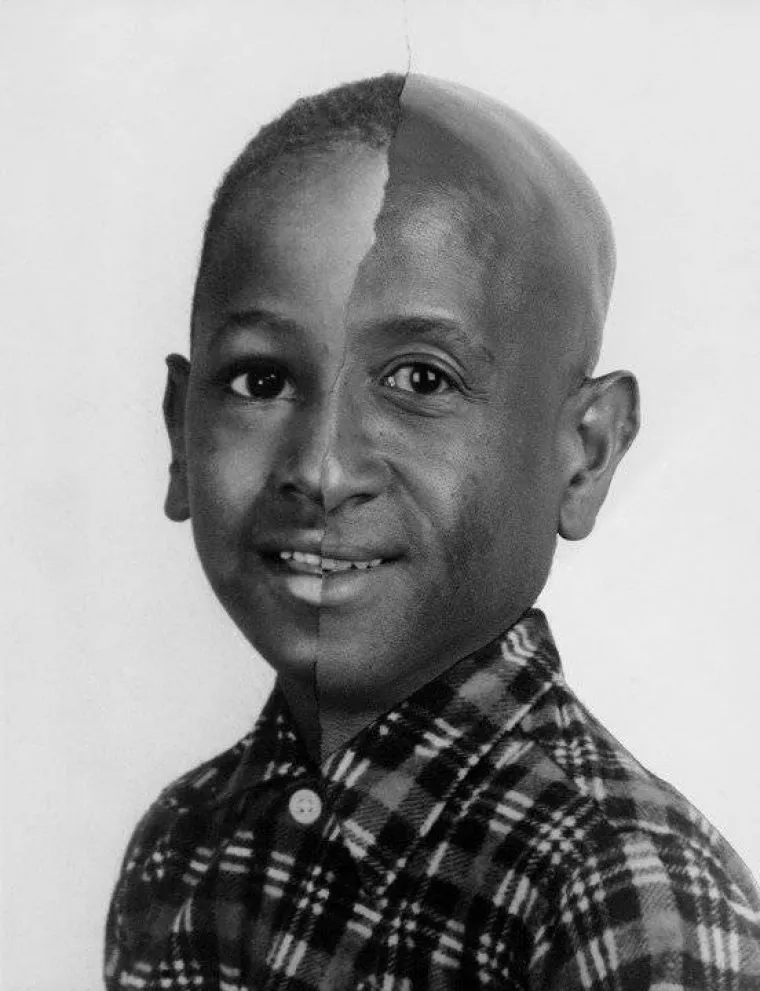 POGLEDAJTE KAKO SE LICA MIJENJAJU KROZ GODINE: Promjene kojima jednostavno ne možemo pobjeći