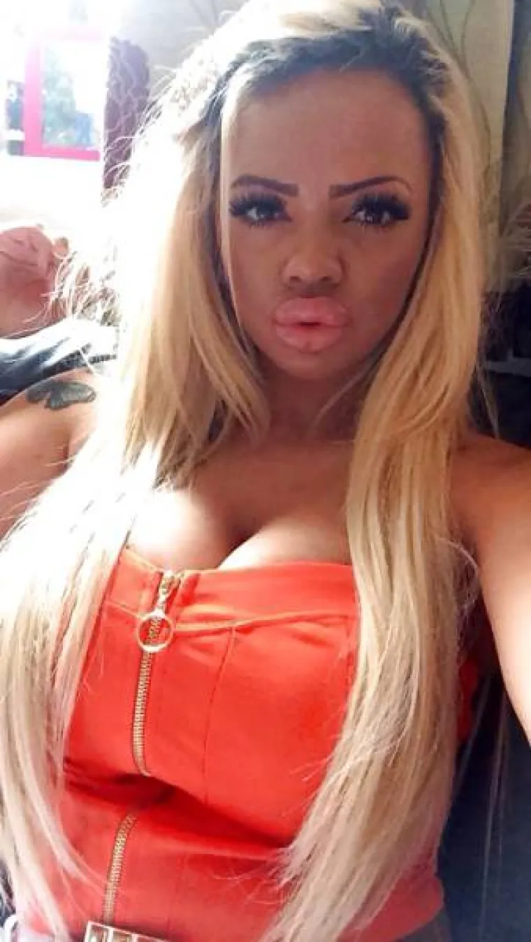 S MALO MA&Scaron;TE I PUNO PARA, SVATKO MOŽE POSTATI JEZIVA SPODOBA: Tek joj je 20, a već je silikonska veteranka